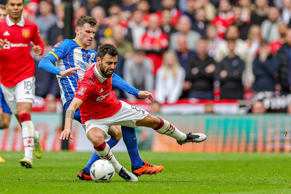 brighton manu prognostika novibet